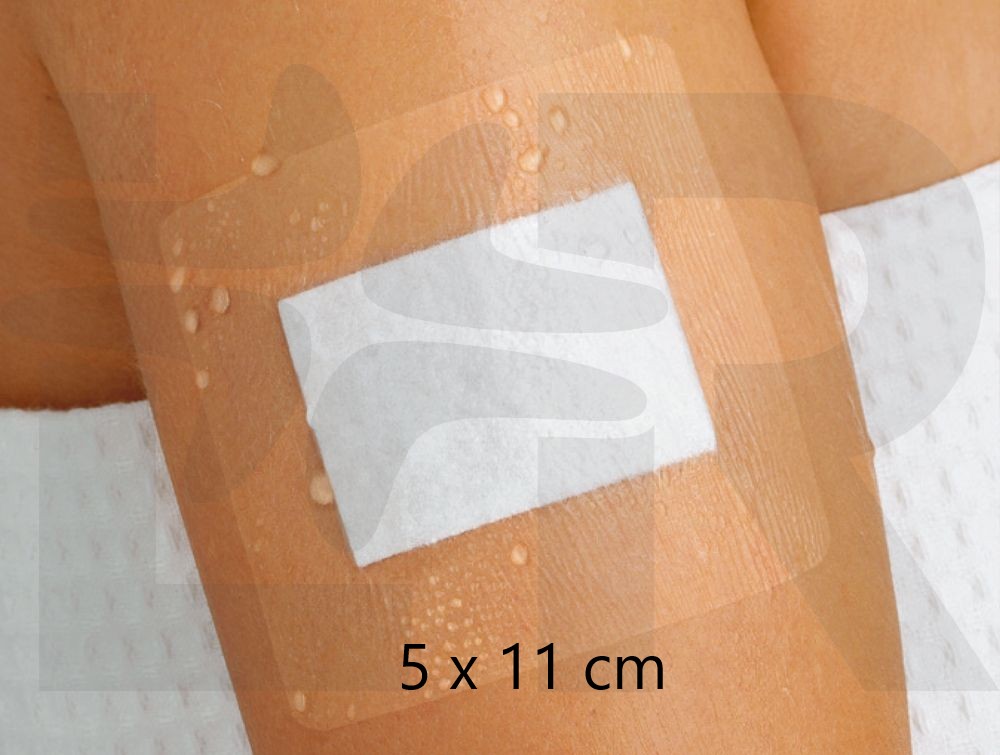 Curapor transparent, steril, 10 x 15 cm, 25er Pack